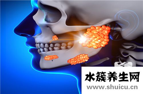 病毒性腮腺炎