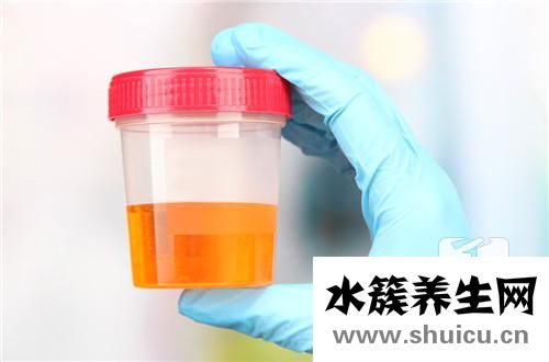 尿白細胞陽性是什么意思