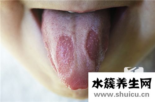 濕熱怎么調理