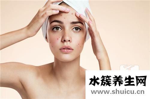 額頭痘痘是什么原因