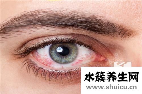 角膜擦傷