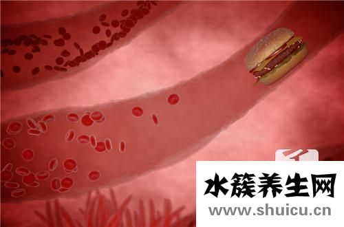 靜脈曲張原因
