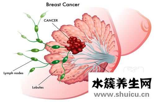 小葉增生怎么治療