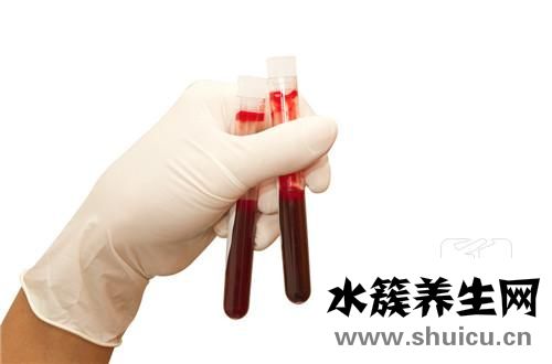 血清尿酸