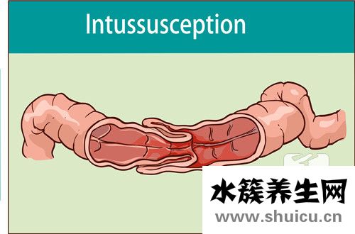腸子疼