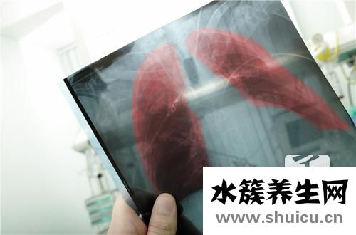 肺炎支原體抗體
