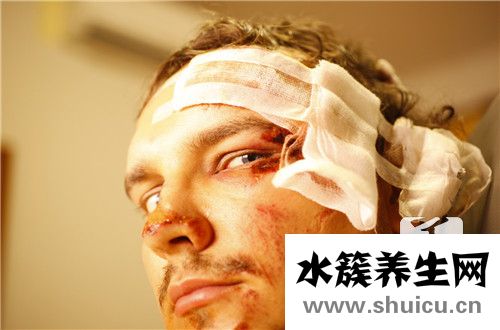 腦血管瘤