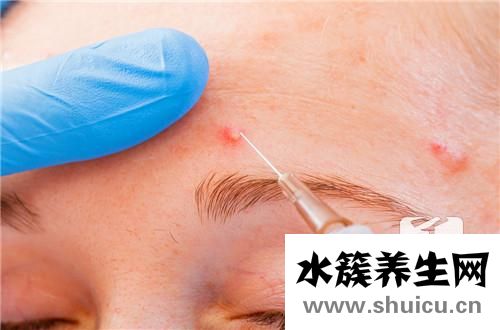 腎上腺皮質激素