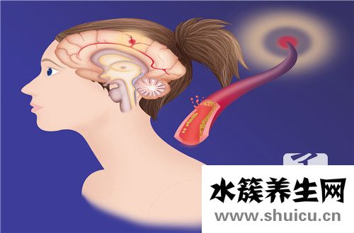 腦膜炎