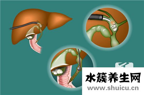 膽堿酯酶偏高