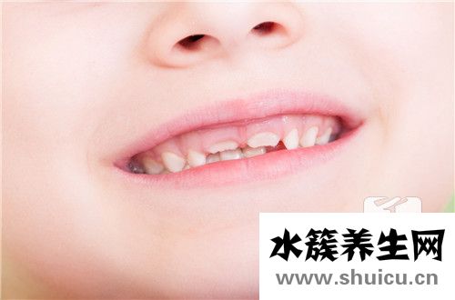 小孩牙齒發黑怎么辦