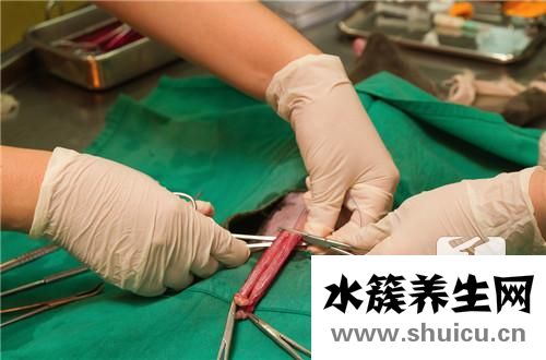 男子結扎
