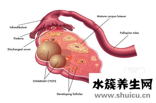 輸卵管堵塞手術