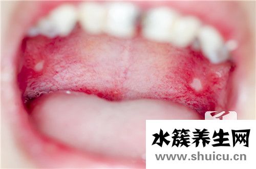 口腔壁