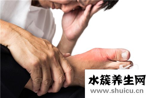 會得痛風