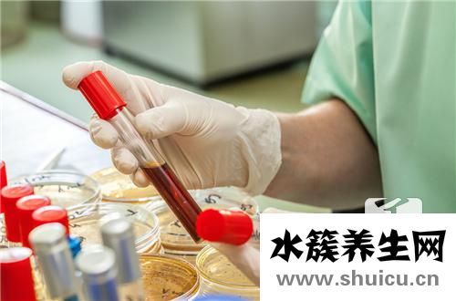 血常規血紅蛋白偏低