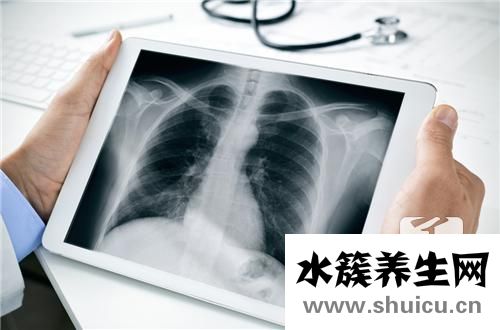 左側胸膜增厚