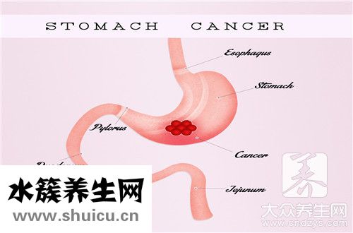 胃竇活檢