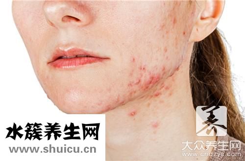 臉上長疙瘩是什么原因