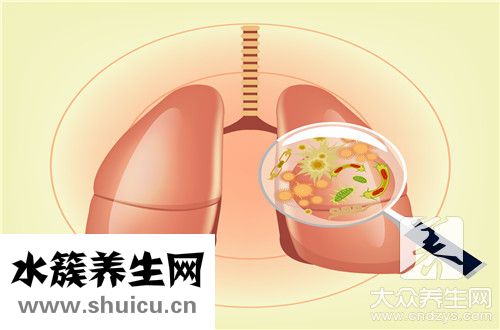 肺切除術