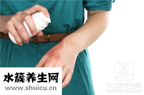 傷口縫針