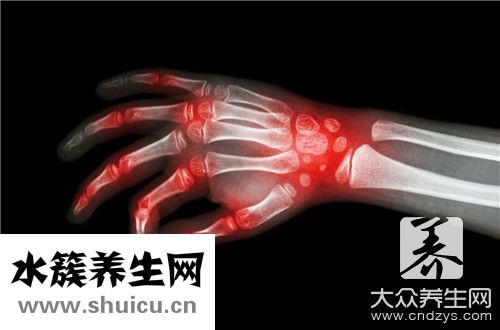 弓形蟲治療