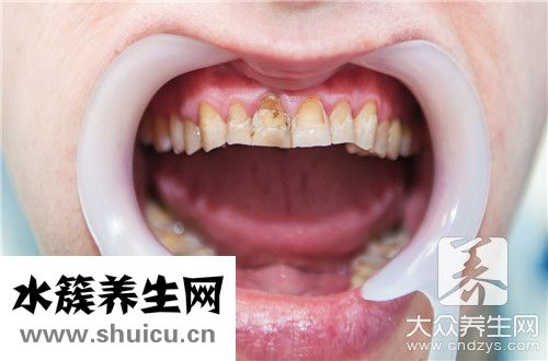 牙上有黑線