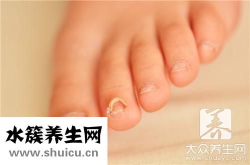 腳趾甲里面有黑塊