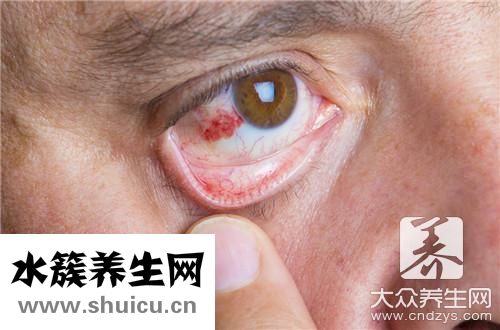 眼角腫痛是什么原因