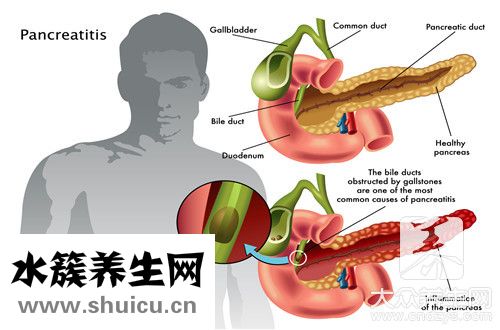 血清膽紅素偏高