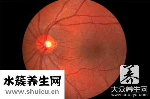 眼底血管堵塞
