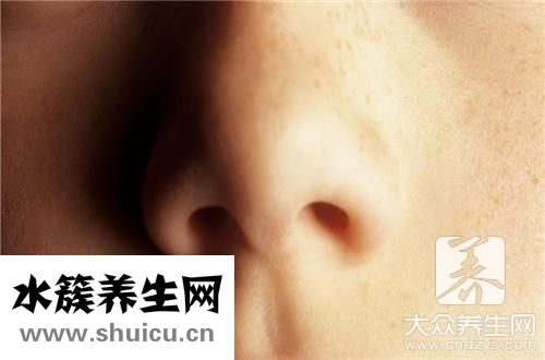 鼻梁骨折