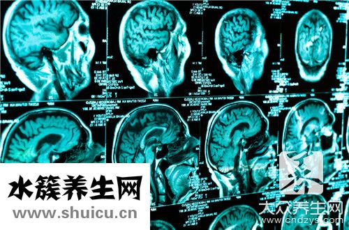 血流信號