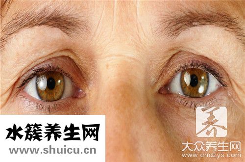 眼袋多久能恢復