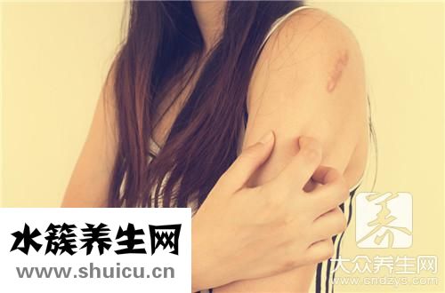皮膚干燥缺什么維生素