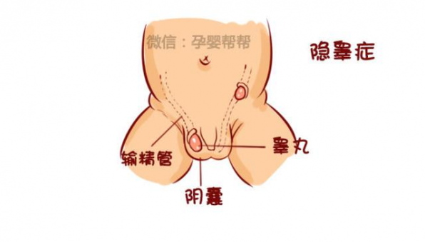 陰囊毛囊炎的癥狀，武漢出現起確診病例