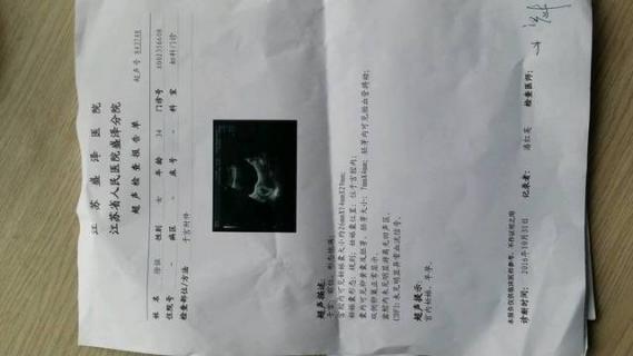 檢查輸卵管是否堵塞做什么檢查最好（檢查輸卵管是否堵塞做什么檢查）