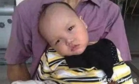 八個動作看寶寶腦癱圖（腦癱的早期癥狀嬰兒圖）