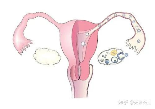 輸卵管堵塞手術費用大概要多少（輸卵管堵塞有什么辦法可以懷孕）