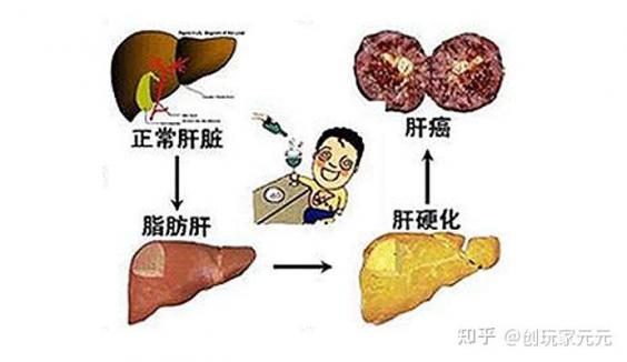 肝出現問題有哪些信號（肝臟疾病有哪些癥狀）