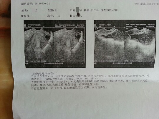 為什么會盆腔積液是怎么引起的（盆腔積液是怎么引起的）