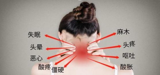 頸椎病是什么癥狀（神經根型的頸椎病是什么癥狀）